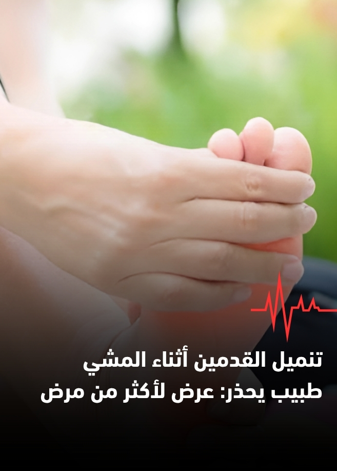 تنميل القدمين أثناء المشي- طبيب يحذر: عرض لأكثر من مرض