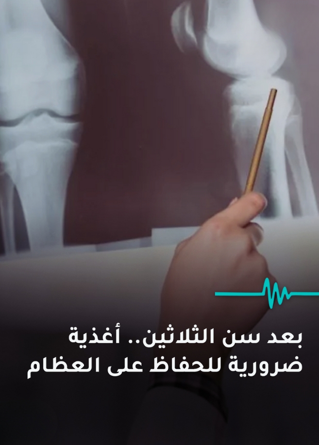 بعد سن الثلاثين.. أغذية ضرورية للحفاظ على العظام