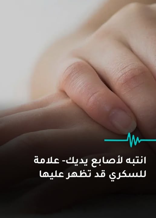 انتبه لأصابع يديك علامة تحذيرية للسكري قد تظهر عليها