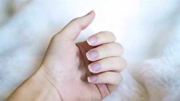 مشكلات صحية تسبب هشاشة الأظافر احذرها